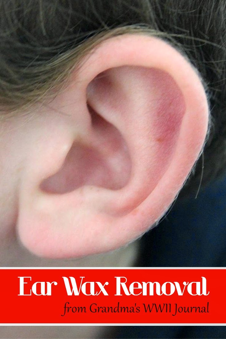 Home Remedy For Ear Wax Removal